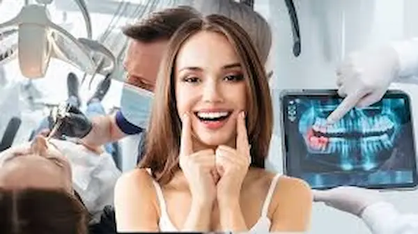 Beneficios de seguir los cuidados después de blanqueamiento dental
